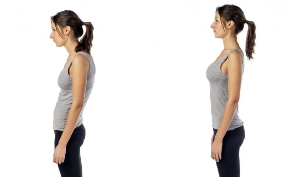 6 Neck Posture Exercises That Fix Forward Head & Back Pain
