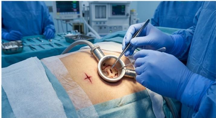 Minimally Invasive Spine Surgery in Houston: Your Advanced Path to a Pain-Free Life
